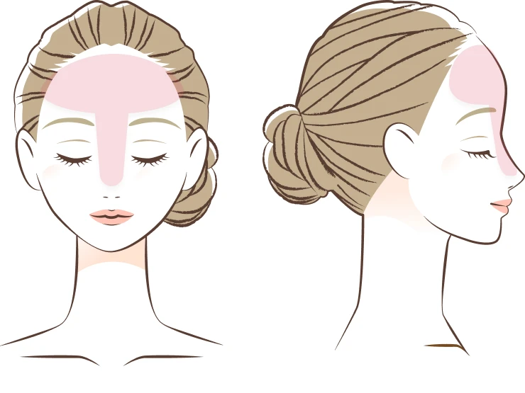 思春期ニキビのできやすい部位