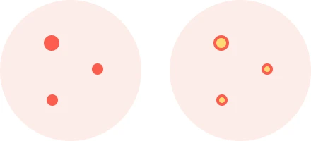 赤ニキビと黄ニキビ