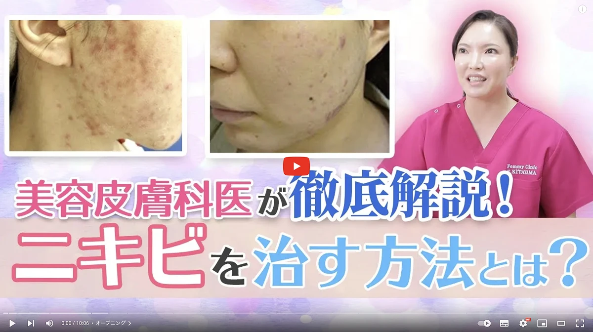 美容皮膚科医が徹底解説! ニキビを治す方法とは?