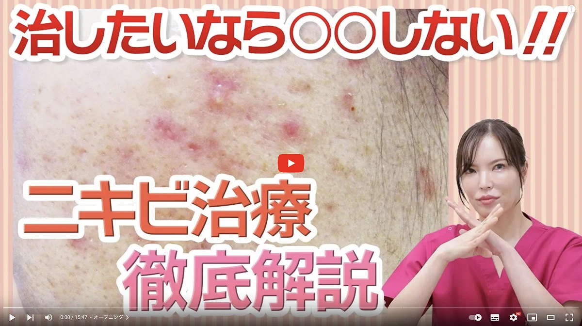 〜ニキビ治療完全マニュアル〜