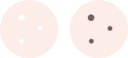 白ニキビと黒ニキビ