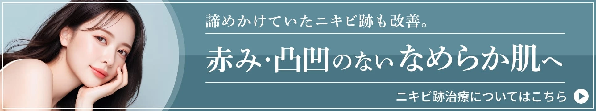 ニキビ跡治療