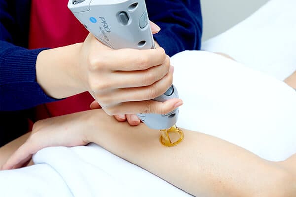 痛みやダメージを最小限に抑える工夫