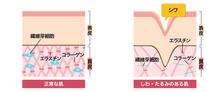 たるみの基礎知識