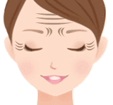 表情じわ