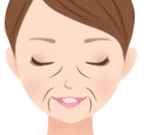 たるみじわ