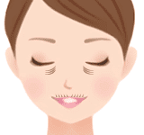 小じわ（ちりめんじわ）