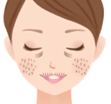 1.皮膚のたるみ