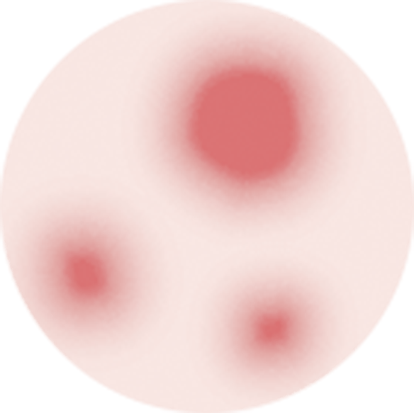 赤み