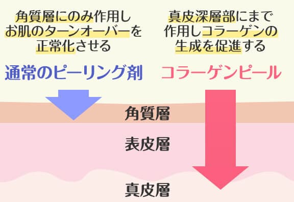 マッサージピールの特徴