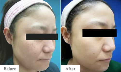 フォトSRのbefore after