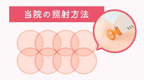 定期的な研修による照射技術の向上