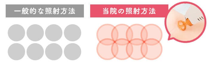“ツルすべ美肌”をつくる顔脱毛