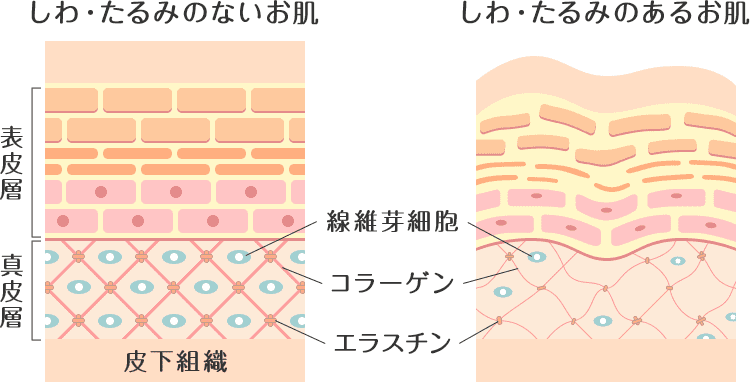 ベビーコラーゲンとは