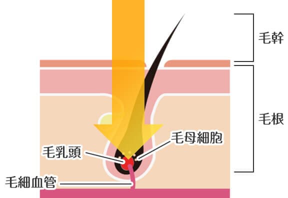 医療脱毛の仕組み