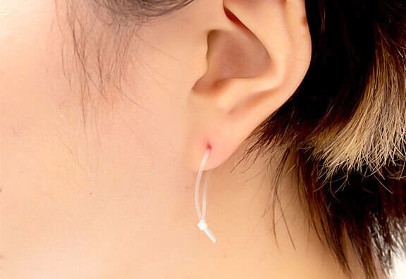 万が一の肌トラブルにもしっかり対応
