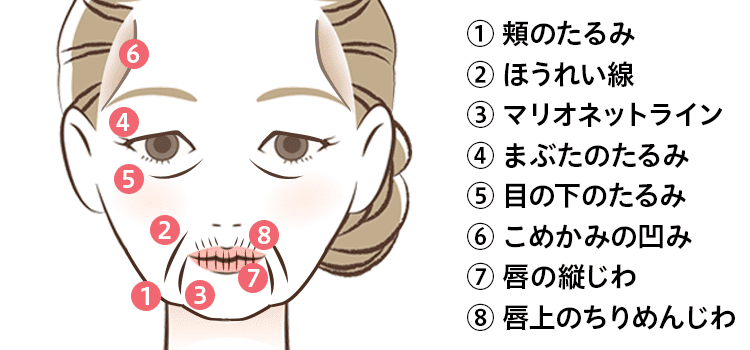 骨の萎縮によって生じる肌トラブル