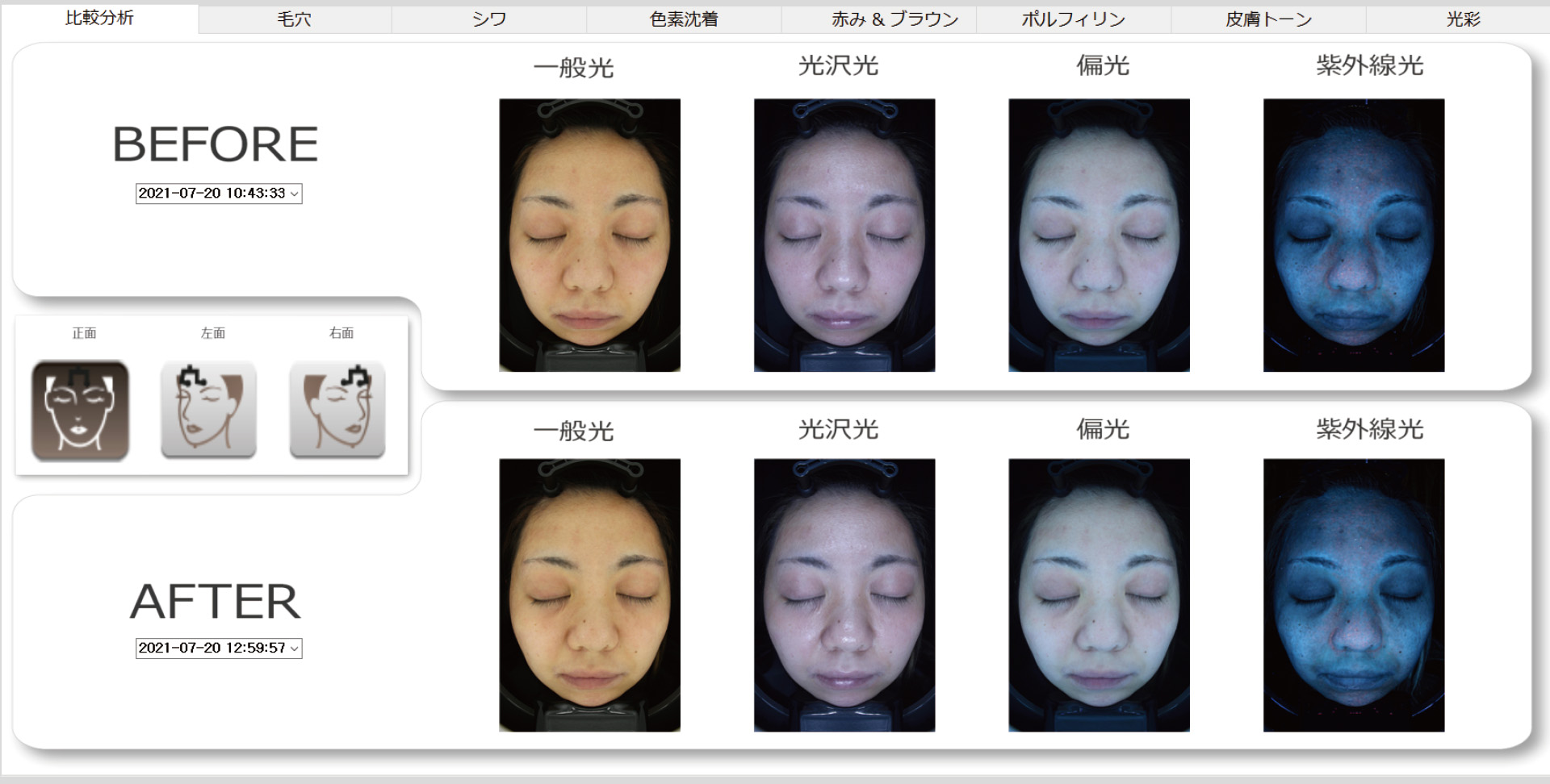 ビフォーとアフターで比較分析が可能