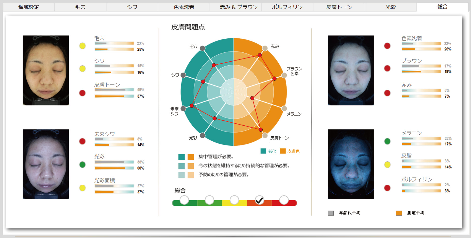 NeoVoirⅠの診断結果を分析