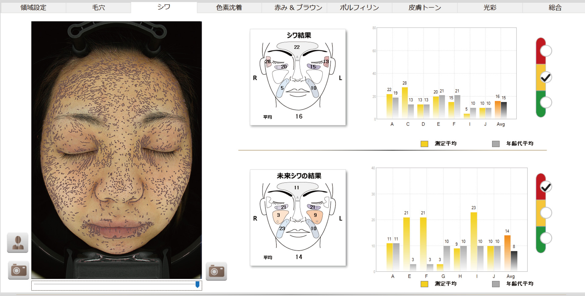 今後生じる未来のシワを予測