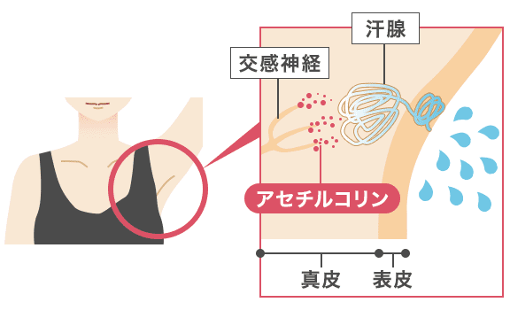少ない施術回数で永久脱毛できる