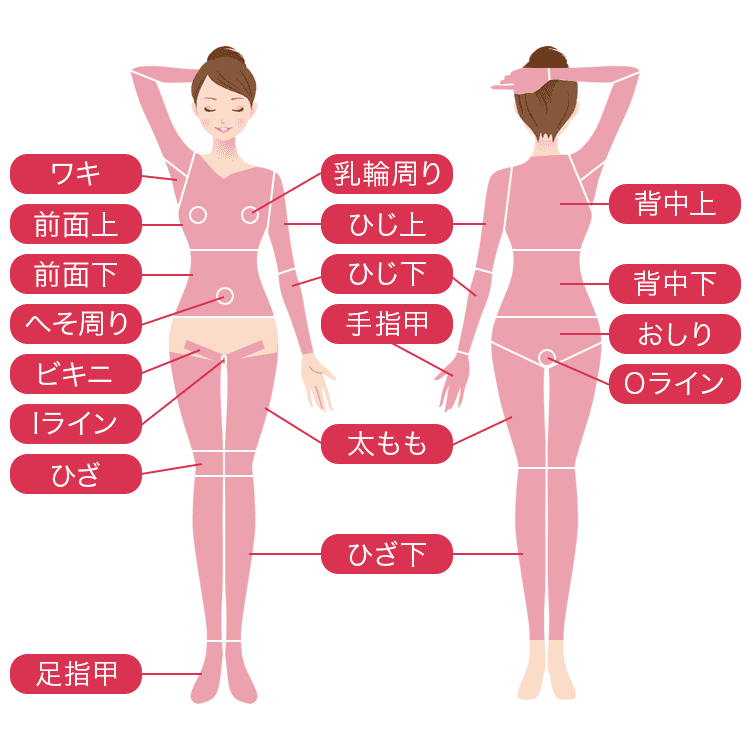 脱毛部位