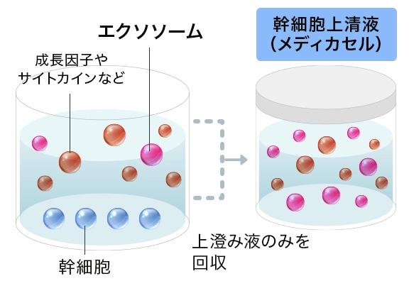 エクソソームとの違い