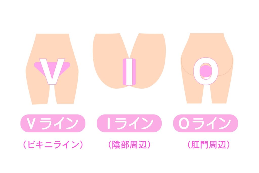 VIO