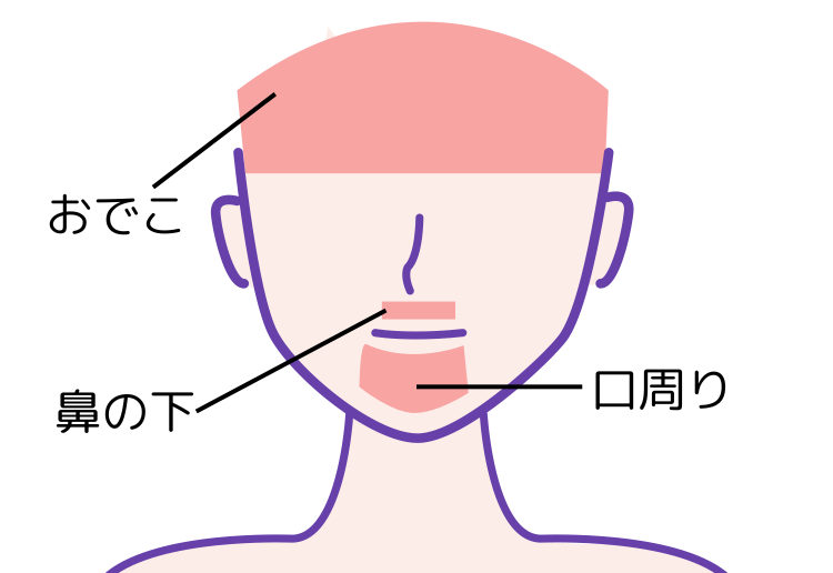 顔の中で特に痛みを感じやすいおでこ、鼻の下、口周り