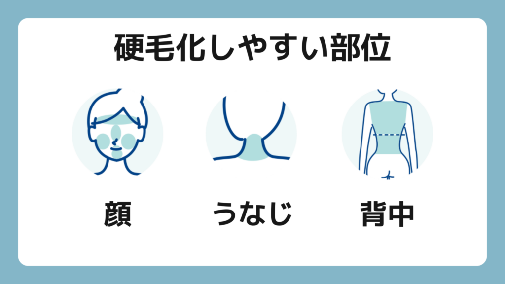 硬毛化しやすい部位は顔、うなじ、背中