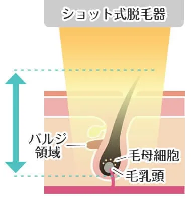 熱破壊式（ショット式）の照射イメージ
