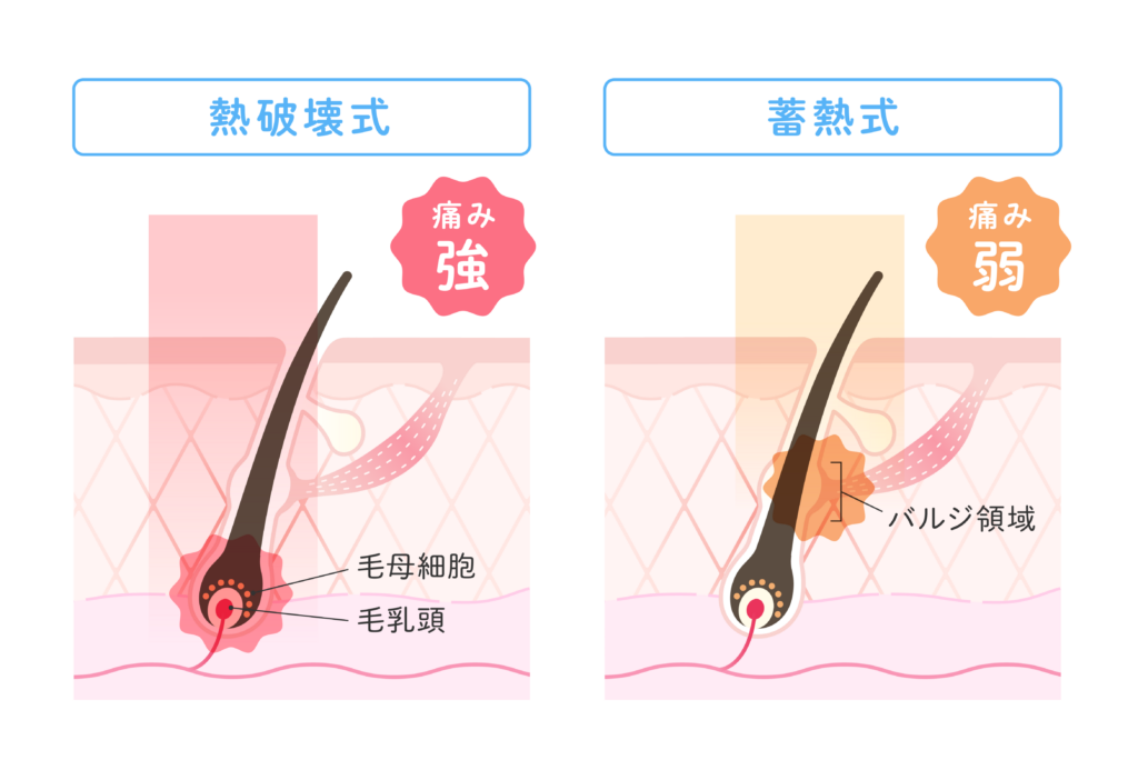 蓄熱式と熱破壊式の違い