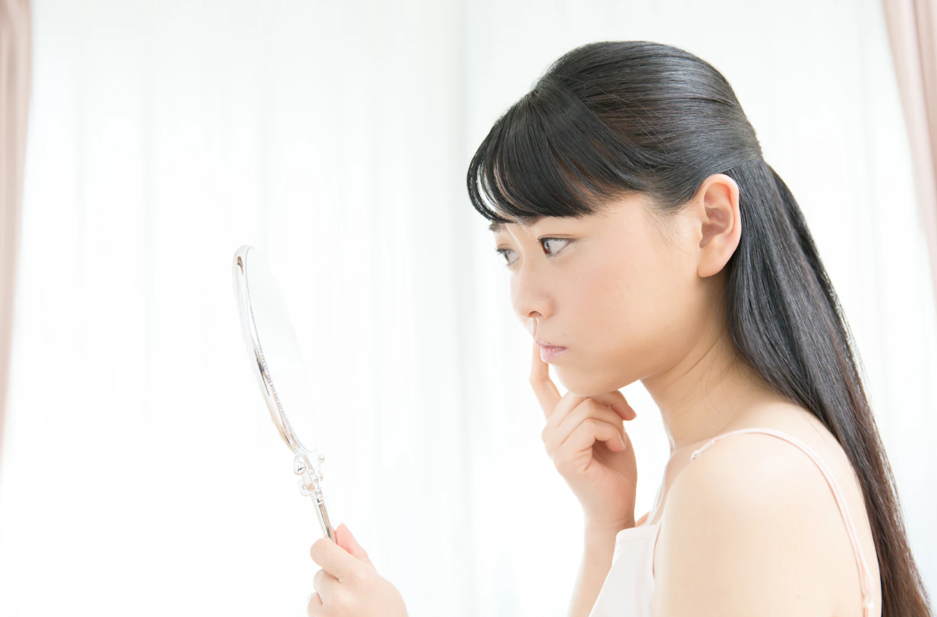 頬ニキビが治らない原因とは？自分でできる対策とキレイに治す美肌治療を解説