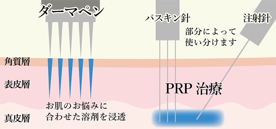 ヴァンパイアプログラム