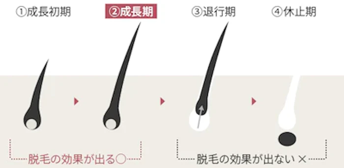 VIO脱毛は何回やればいいの？