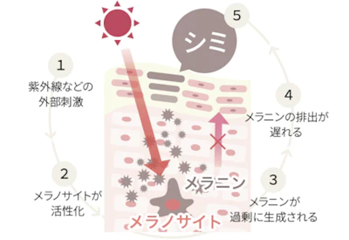 シミの原因とは？紫外線はお肌の大敵