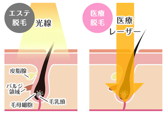 その① エネルギーの強さが違う