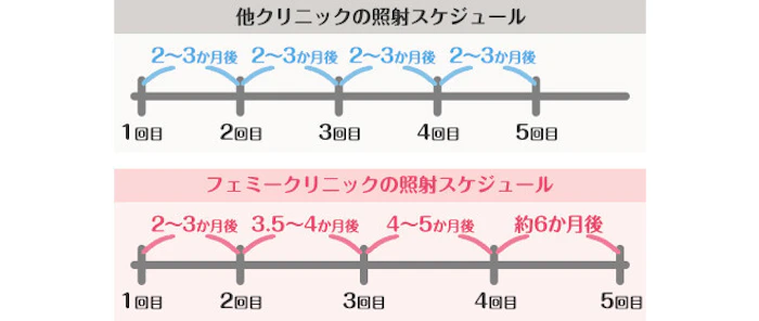 フェミークリニックはベストな間隔で医療脱毛を行います