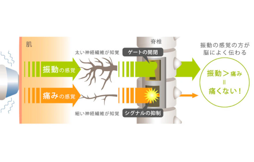 痛みを軽減する仕組み