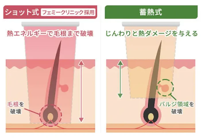 効果の高いショット式のマシンを採用