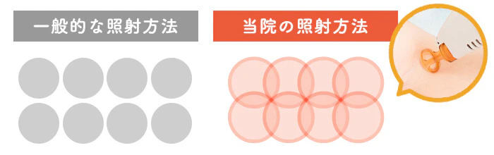 レーザーの照射範囲を1/3づつ重ねて打ち漏れ防止