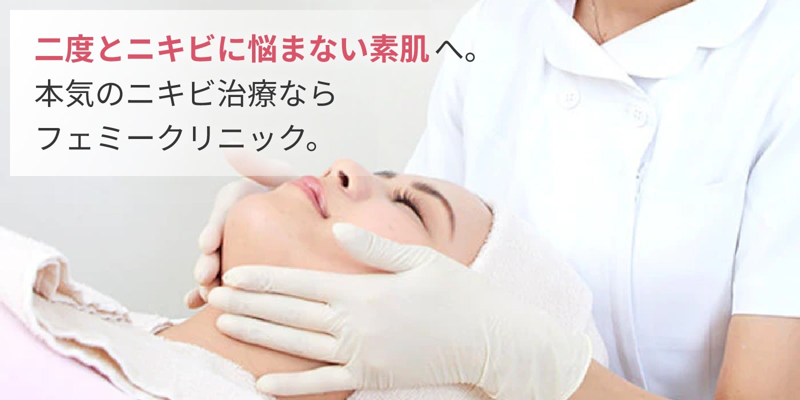 ニキビ治療