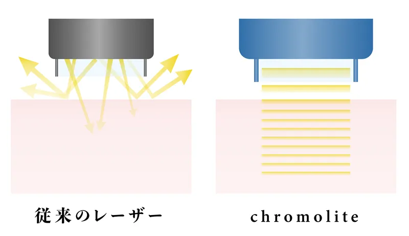 ダウンタイムがほとんどない