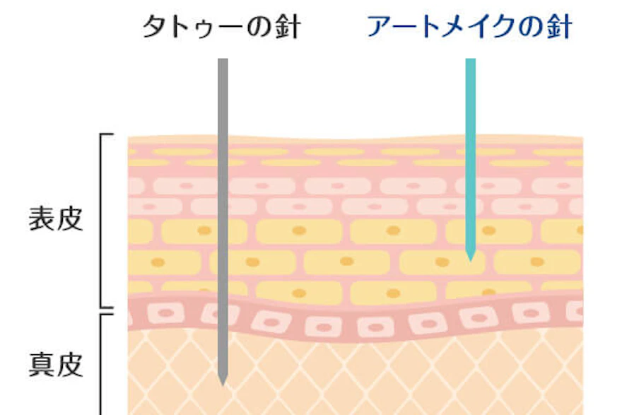 アートメイクは入れ墨とは違い医療行為です