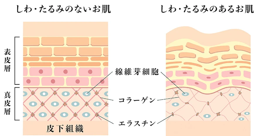 サーマクールとは？