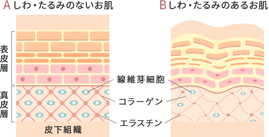 しわ・たるみの原因とは？