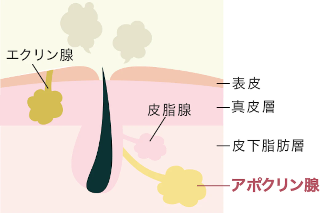 ワキガ（腋臭症）の原因と特徴