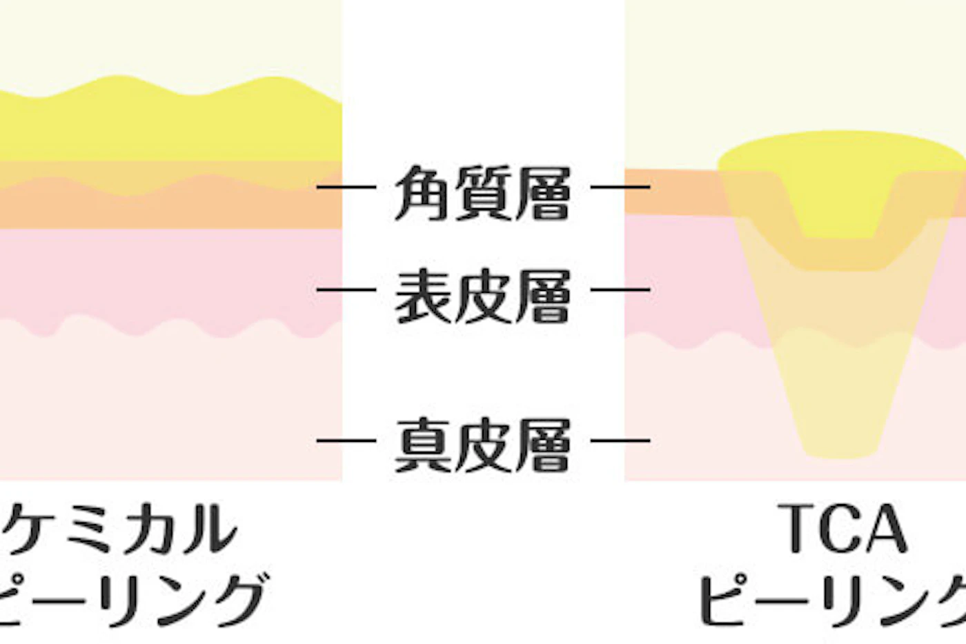 特徴1 お肌の真皮層まで浸透し、コラーゲンの生成を促進