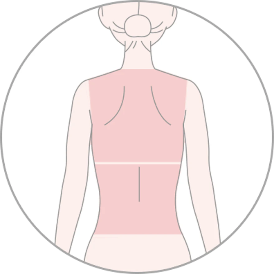 背中脱毛の照射範囲
