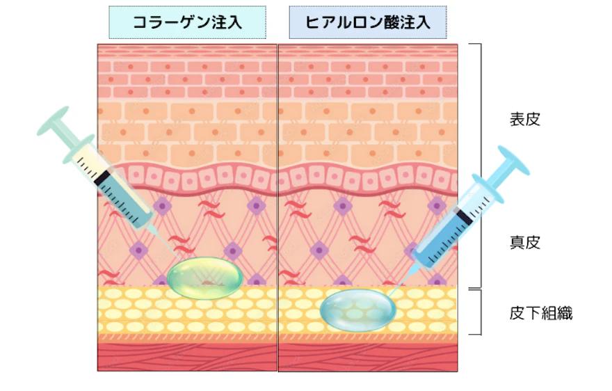 チンダル現象